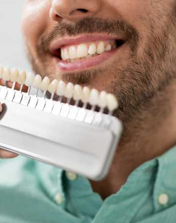 Composite Veneers Near Me in Downers Grove, IL Composite Veneers Near Me in Downers Grove, IL
