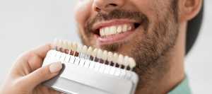 Composite Veneers Specialist Near Me in Downers Grove, IL Composite Veneers Specialist Near Me in Downers Grove, IL