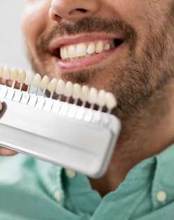 Composite Veneers Near Me in Downers Grove, IL Composite Veneers Near Me in Downers Grove, IL