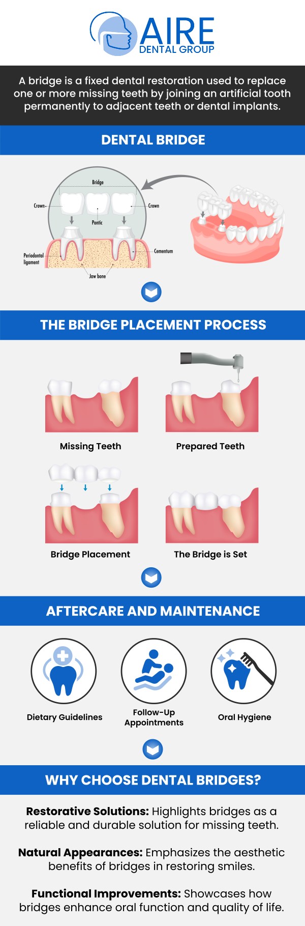 Common questions asked by patients: What is a fixed dental bridge? How does a fixed dental bridge replace missing teeth? Who is a good candidate for a dental bridge? How many teeth can a bridge replace? For more information, contact us or request an appointment online. We serve patients from Downers Grove IL, Westmont IL, Lisle IL, Woodridge IL, Darien, IL, Hinsdale, IL and surrounding areas. Common questions asked by patients: What is a fixed dental bridge? How does a fixed dental bridge replace missing teeth? Who is a good candidate for a dental bridge? How many teeth can a bridge replace? For more information, contact us or request an appointment online. We serve patients from Downers Grove IL, Westmont IL, Lisle IL, Woodridge IL, Darien, IL, Hinsdale, IL and surrounding areas.