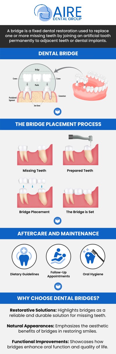 Common questions asked by patients: What is a fixed dental bridge? How does a fixed dental bridge replace missing teeth? Who is a good candidate for a dental bridge? How many teeth can a bridge replace? For more information, contact us or request an appointment online. We serve patients from Downers Grove IL, Westmont IL, Lisle IL, Woodridge IL, Darien, IL, Hinsdale, IL and surrounding areas. Common questions asked by patients: What is a fixed dental bridge? How does a fixed dental bridge replace missing teeth? Who is a good candidate for a dental bridge? How many teeth can a bridge replace? For more information, contact us or request an appointment online. We serve patients from Downers Grove IL, Westmont IL, Lisle IL, Woodridge IL, Darien, IL, Hinsdale, IL and surrounding areas.