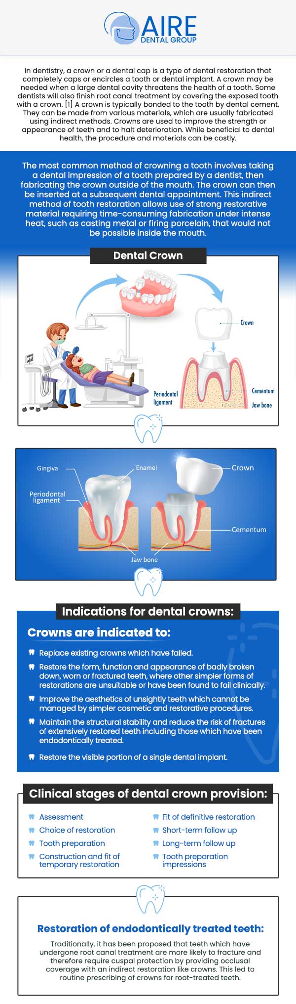 Common questions asked by patients: What is a porcelain crown? When do I need a crown instead of a filling? What is the process for getting a crown? How long do porcelain crowns last? For more information, contact us or request an appointment online. We serve patients from Downers Grove IL, Westmont IL, Lisle IL, Woodridge IL, Darien, IL, Hinsdale, IL and surrounding areas. Common questions asked by patients: What is a porcelain crown? When do I need a crown instead of a filling? What is the process for getting a crown? How long do porcelain crowns last? For more information, contact us or request an appointment online. We serve patients from Downers Grove IL, Westmont IL, Lisle IL, Woodridge IL, Darien, IL, Hinsdale, IL and surrounding areas.