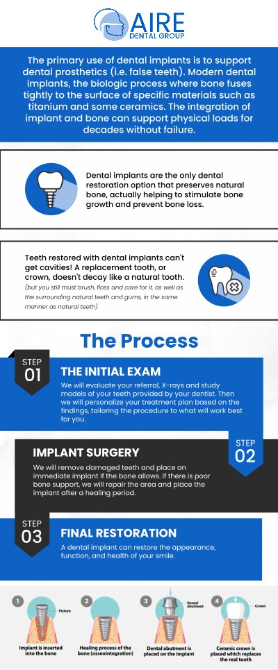 At Aire Dental Group, our team specializes in dental implants, a permanent solution for missing teeth. By replacing the tooth's root, implants provide a stable and secure foundation for a new tooth, preventing bone loss and restoring your ability to eat, speak, and smile with confidence. For more information, contact us or request an appointment online. We are conveniently located at 6224 Main St suite c, Downers Grove, IL 60516. At Aire Dental Group, our team specializes in dental implants, a permanent solution for missing teeth. By replacing the tooth's root, implants provide a stable and secure foundation for a new tooth, preventing bone loss and restoring your ability to eat, speak, and smile with confidence. For more information, contact us or request an appointment online. We are conveniently located at 6224 Main St suite c, Downers Grove, IL 60516.
