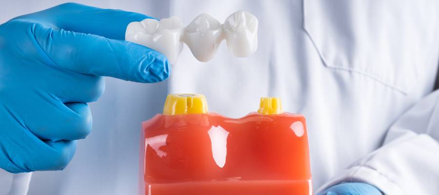 Fixed Dental Bridges Near Me in Downers Grove, IL Fixed Dental Bridges Near Me in Downers Grove, IL