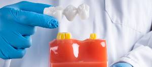 Fixed Dental Bridges Near Me in Downers Grove, IL Fixed Dental Bridges Near Me in Downers Grove, IL