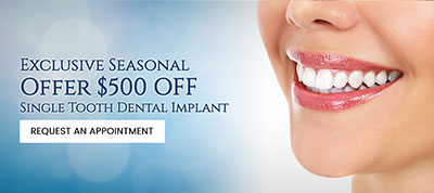 Dental Implants Specialist in Downers Grove, IL